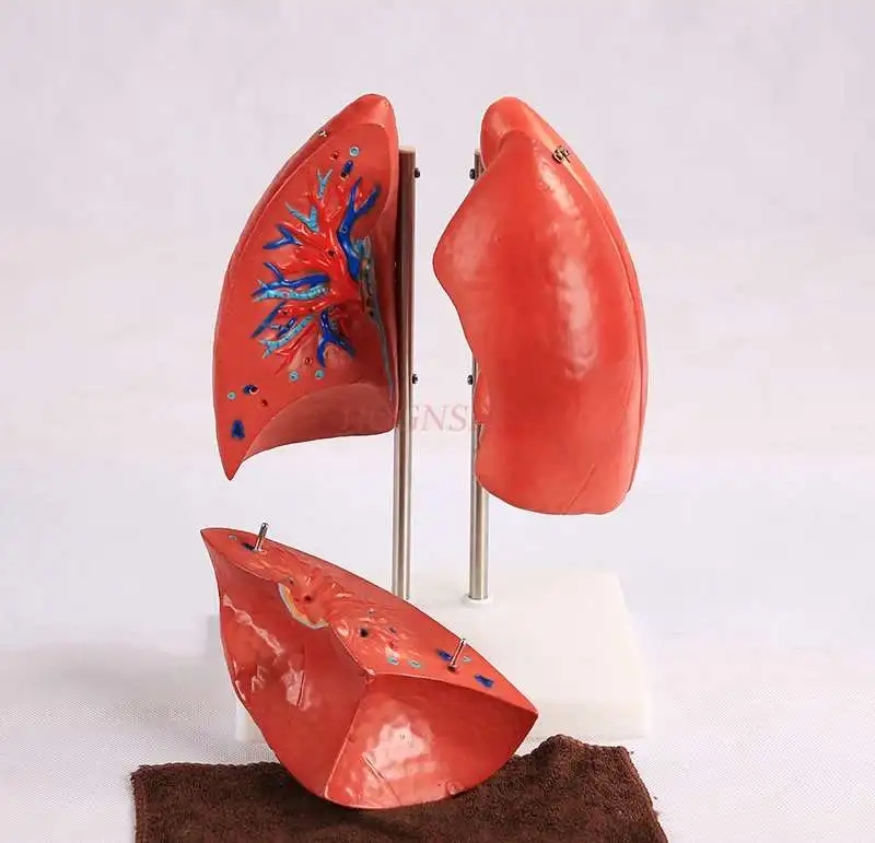 Легких модель медицинского слуховые аппараты Легочное Дыхание легких