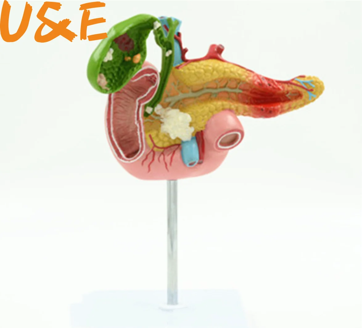 Патологическая модель панкреи дуоденовой и желчного пузыря | Канцтовары для