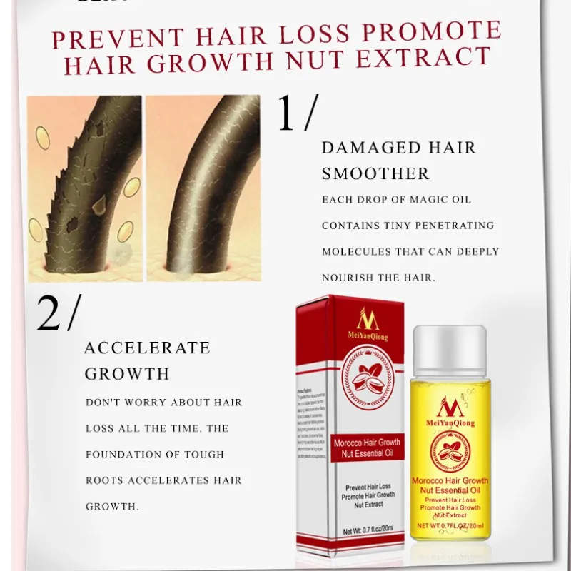 Имбирное масло для роста волос 20 мл быстрого имбирный шампунь лечения выпадения |