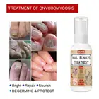 Пилка Для лечения Ногтей, антиудаление ногтей, онихомикоз, грибок, осветляющая эссенция, восстанавливающая сыворотка, инструменты для ухода за кожей ног, 50 мл