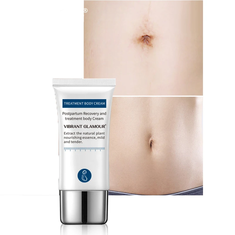 

Средство для удаления растяжек под крокодиловую кожу один раз крем для восстановления шрамов от старения и подтяжки морщин