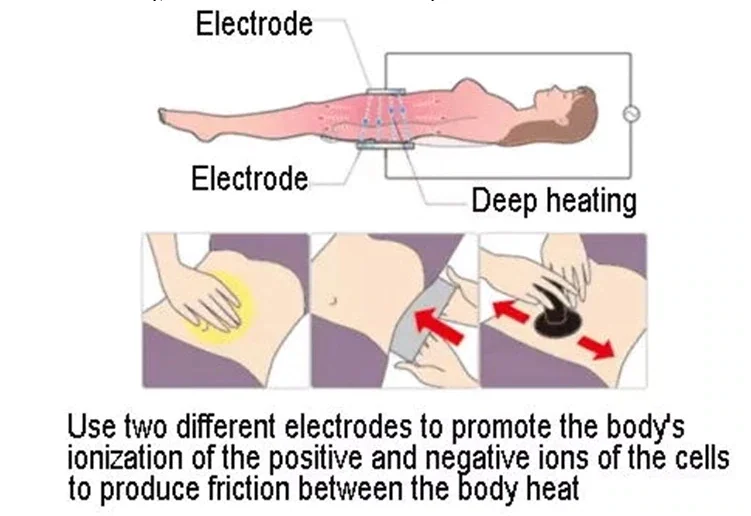 Indiba CET RET fat removal machine pain relief Proionic System High Frequency Heating body care equipment