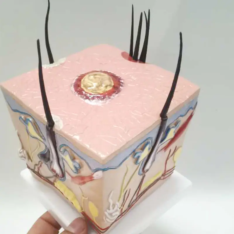 Человеческое тело здоровый процесс роста волос расширение волосяного фолликула