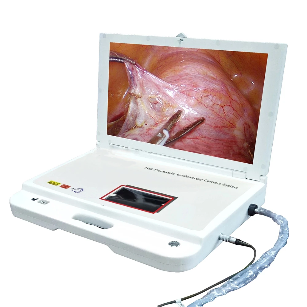 

Medical HD Endoscope Camera unit ENT portable endoscopy camera system with light source