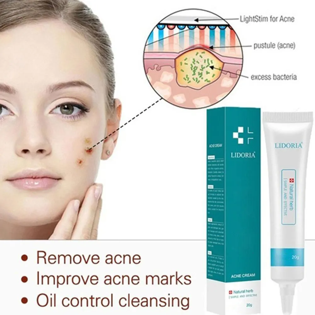 

Effective Acne Removal Cream Acne Treatment Fade Acne Spots Oil Control Shrink Pores Whitening Moisturizing Acne Cream Skin Care