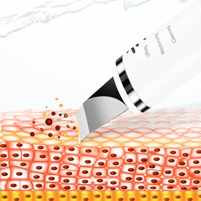 Средство для удаления угрей ионное средство красоты микротоковая Вибрация