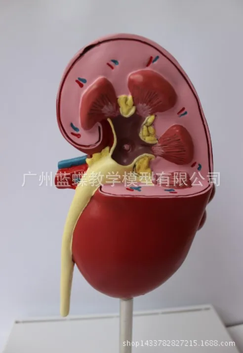 Почечные камни модель заболеваний урология Nephron Renal glomelus анатомическая почечная