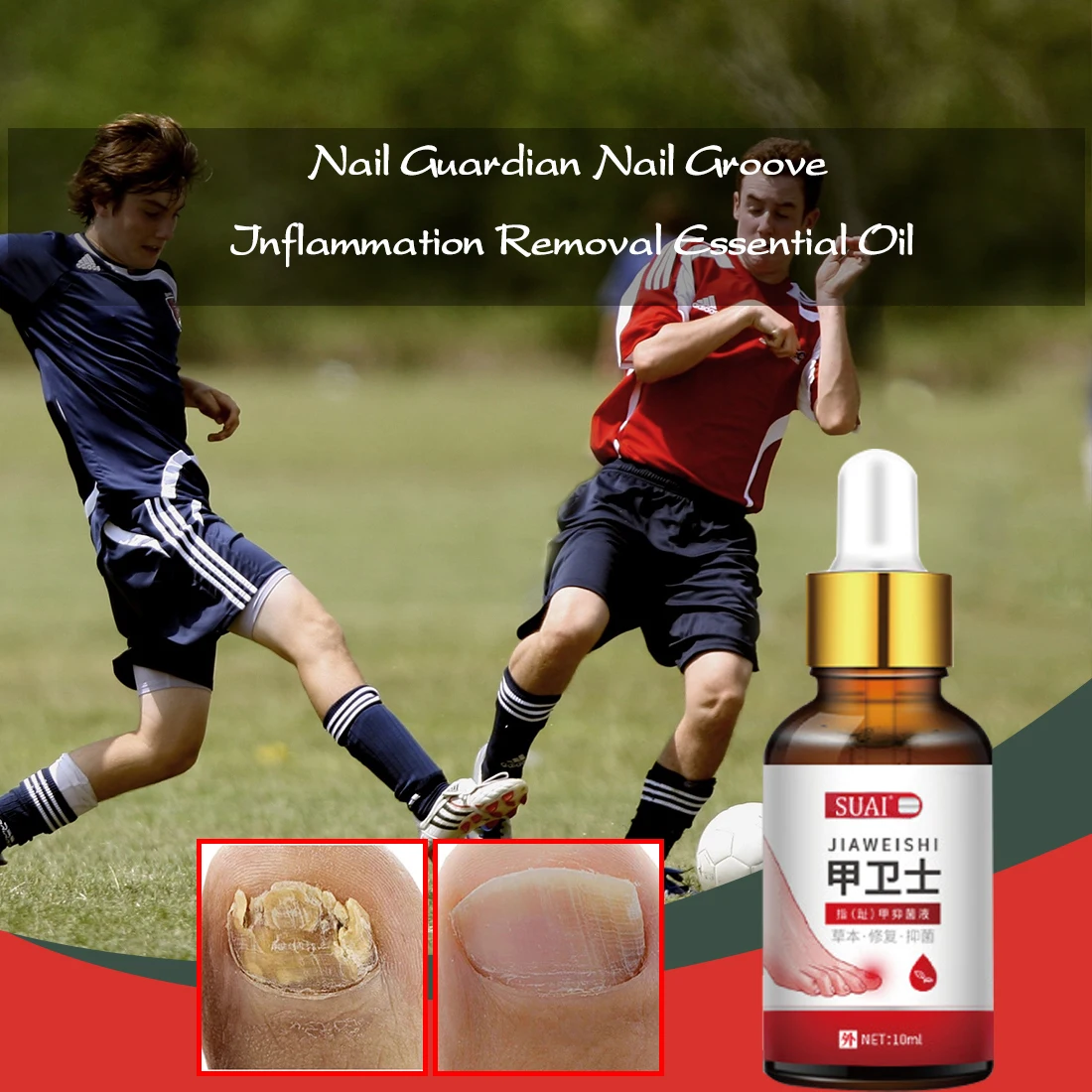 

Nail Fungal Treatment Feet Care Essence Nail Foot Whitening Toe Nail Fungus Removal Gel Anti Infection Paronychia Onychomycosis