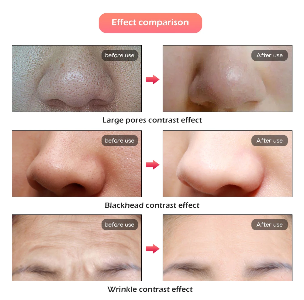 Светодиодная маска для лица 7 цветов красоты, омоложения и устранения морщин с фотонной терапией и отбеливающим уходом за кожей.