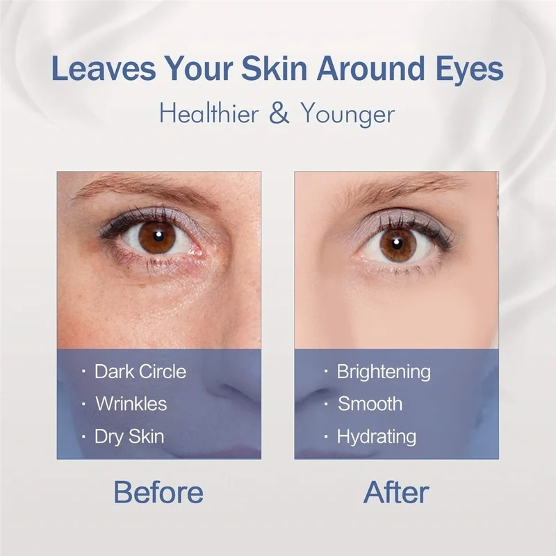 

10/20/30ml Hydrating Eye Cream Six Essence Hyaluronic Acid Essence Eye Serum for Dark Circles and Wrinkles