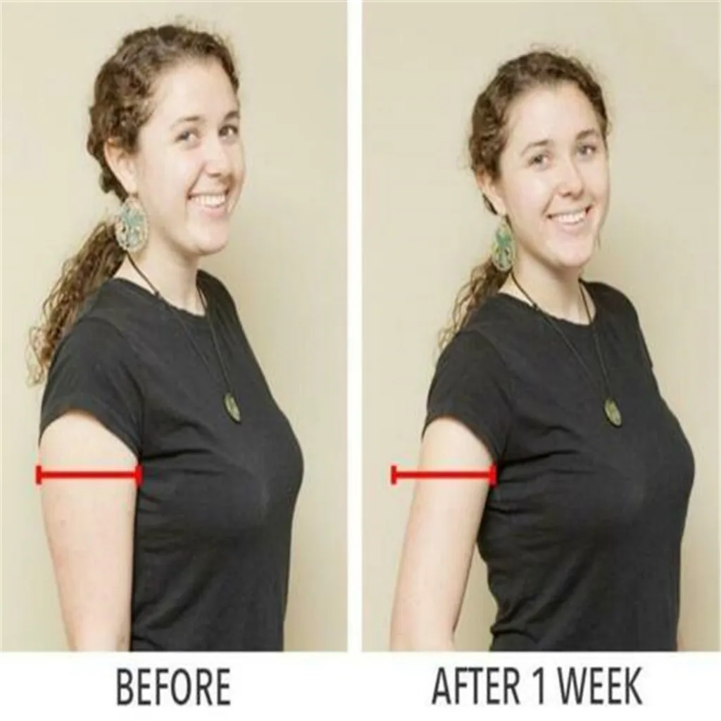 JAYCOSIN повязки на руку эластичная корректирующая одежда chinlon удобные Тонкие