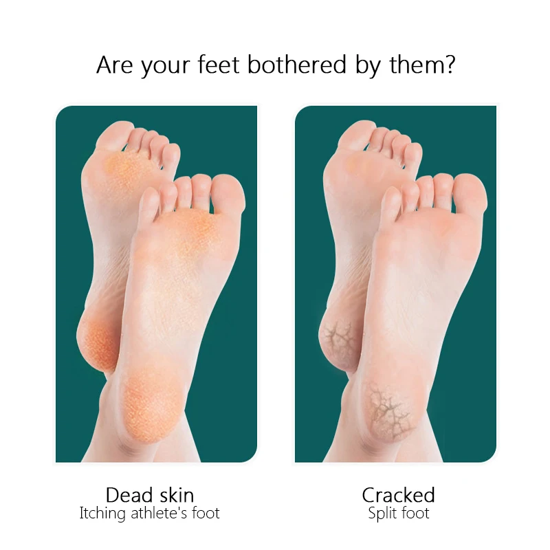 Пилка Для ног из нержавеющей стали шлифовальная Машинка для удаления мозолей