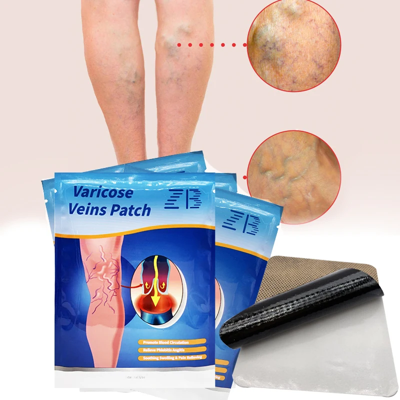 6/12PCS ZB Chinese Herbal Varicose Veins Cure Patch Legs Pain Relief Plaster Spider Varicosity Angiitis Removal Phlebitis Treat | Красота и