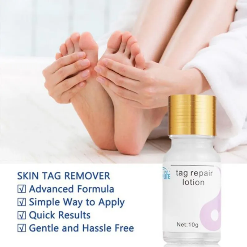 

10ML Skin Tag Remover+10ML Wart Repair Liquid Genital Wart Treatment Instant Removal Mole&Papillomas Foot Corn Repair Tool