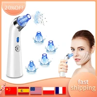 blackhead remover pore vacuum electric tools usb rechargeable with 4 replaceable suction head and 5 adjustable suction power