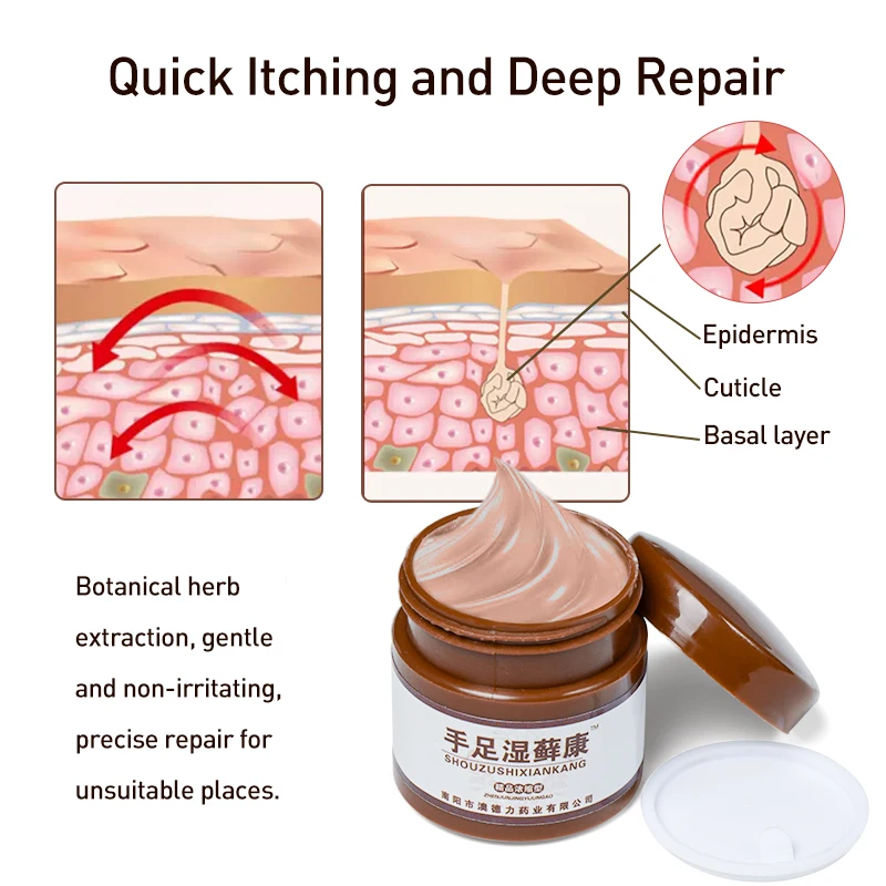 1 шт. мазь от псориаза экзмы антибактериальная грибкового червя дерматита экземы