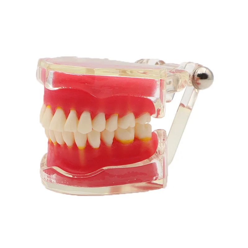 1 Piece Full Mouth Removable Model with 28pcs Teeth and Soft Gum Dental Teeth Model Without Screw for Dental Teaching Training