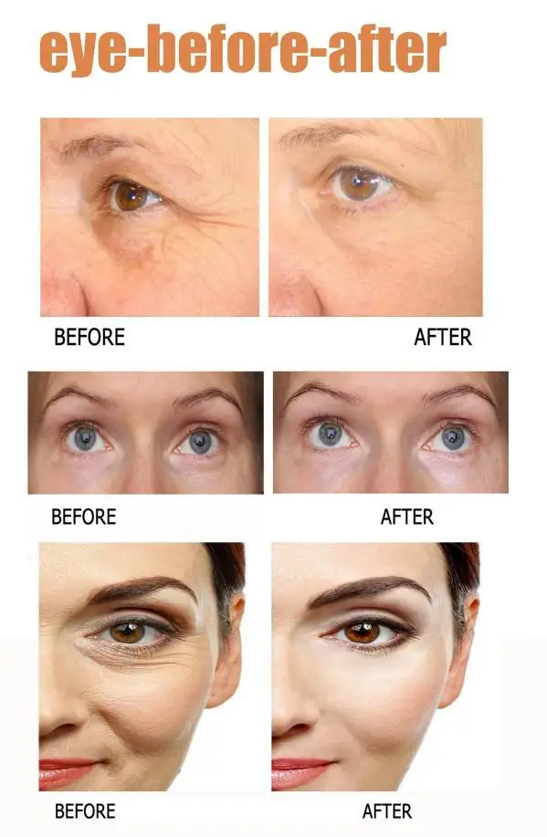 2 минут мгновенный лифтинг насос для перекачки жидкостей ухода за областью