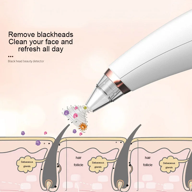 Аккумуляторная электрическая машинка для очистки пор устройство удаления кожи с