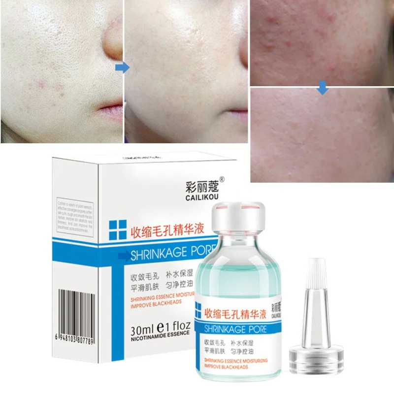

Pores Shrinking Essence Moisturizing Firming Skin Remove Blackheads Acnes Face Serum E1