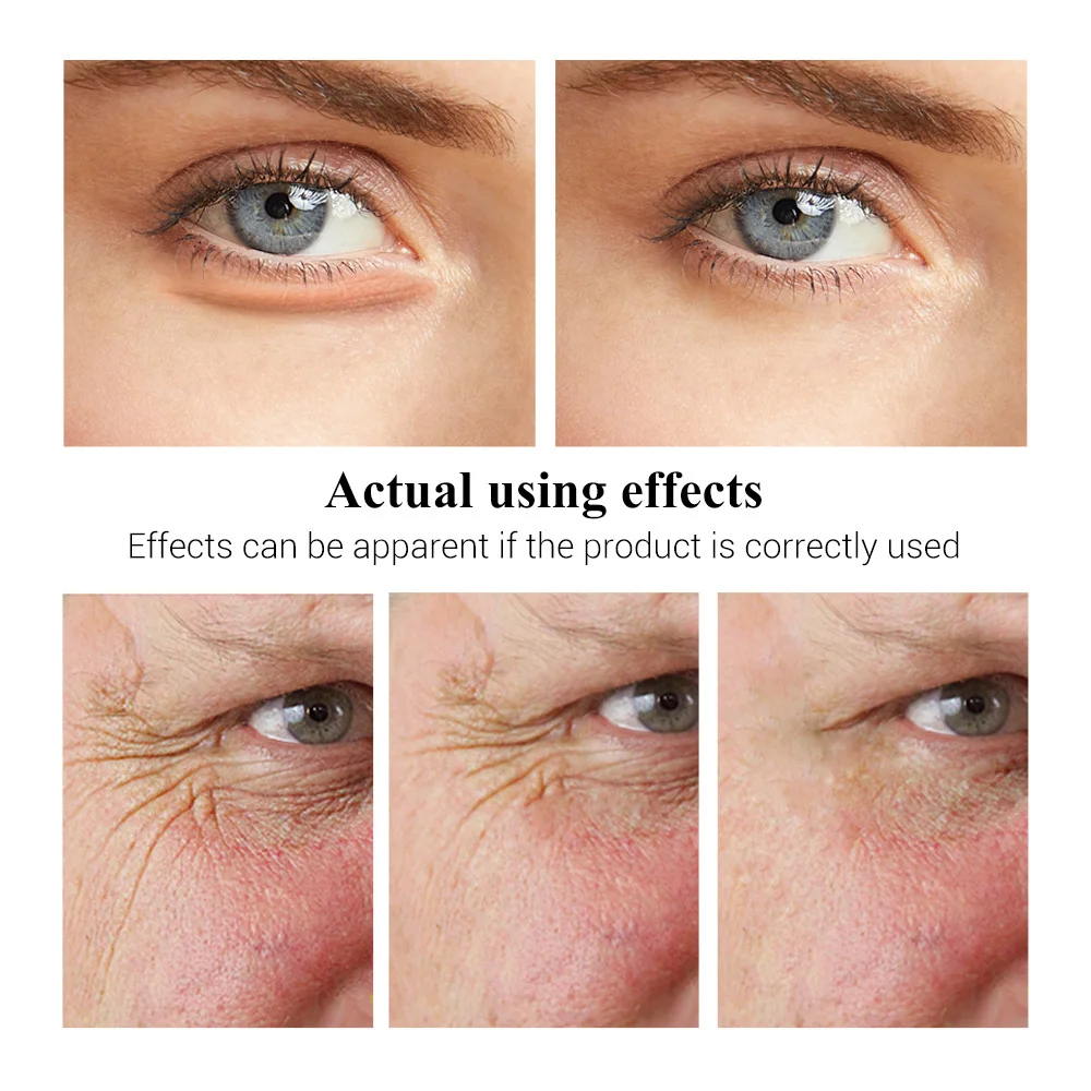 Крем для области вокруг глаз с виноградными косточками увлажняющий укрепляющий