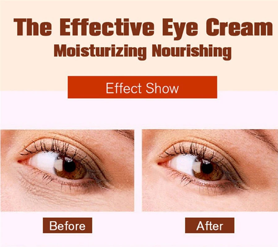 30 мл Улитка эссенция крем для глаз Удаление темный круг удаления укрепляющий