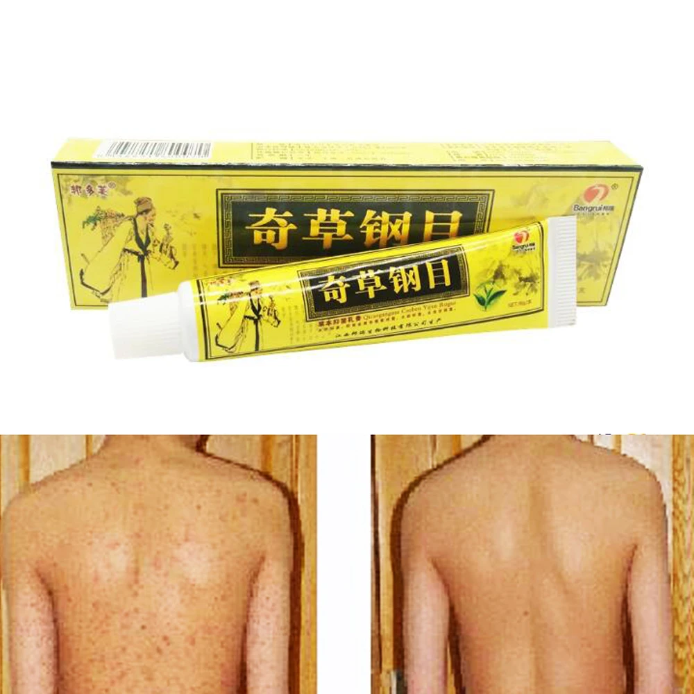 Китайская травяная кожа актуальная антипретическая мазь крем анальгетический