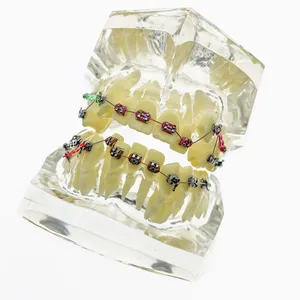 Зубная модель, прозрачная Ортодонтическая модель для лечения зубов, модель для обучения