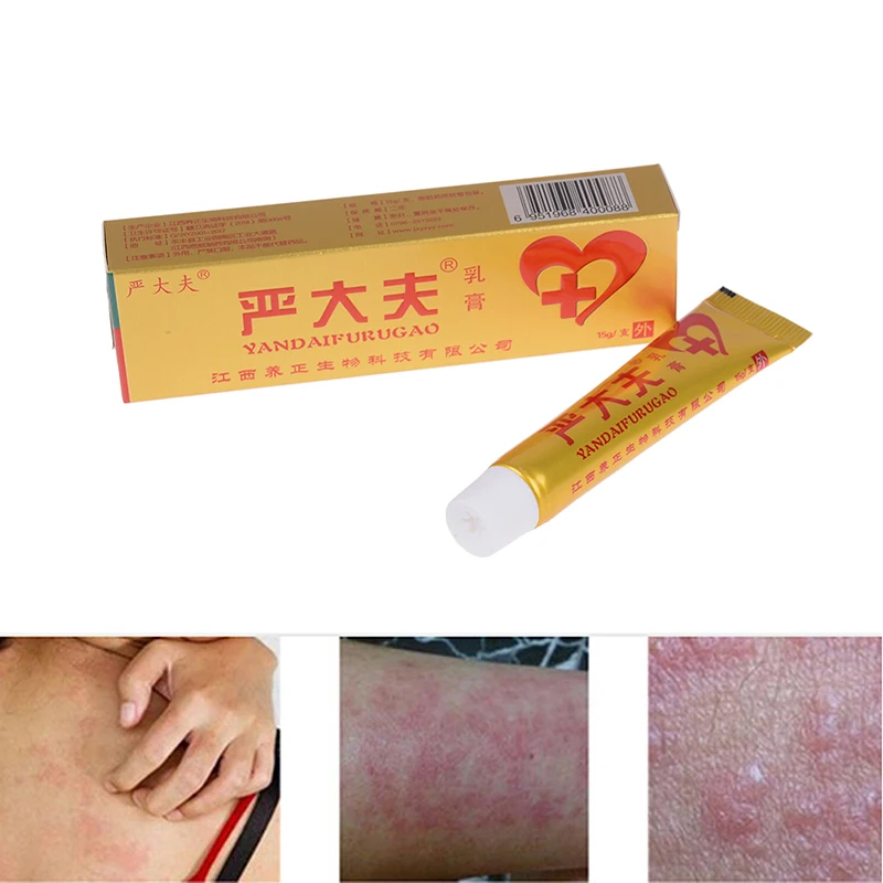 Медицина травяной псориаз мазь крем дерматит экзема для Pruritus лечения псориаза