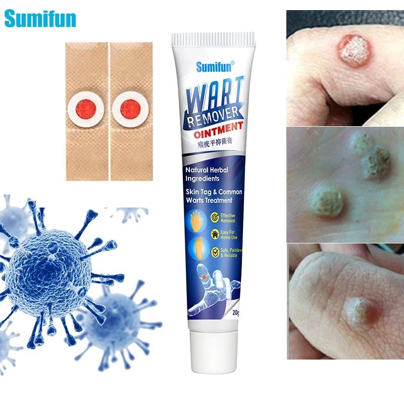 

20-80 шт., пластыри для удаления бородавок на ногах