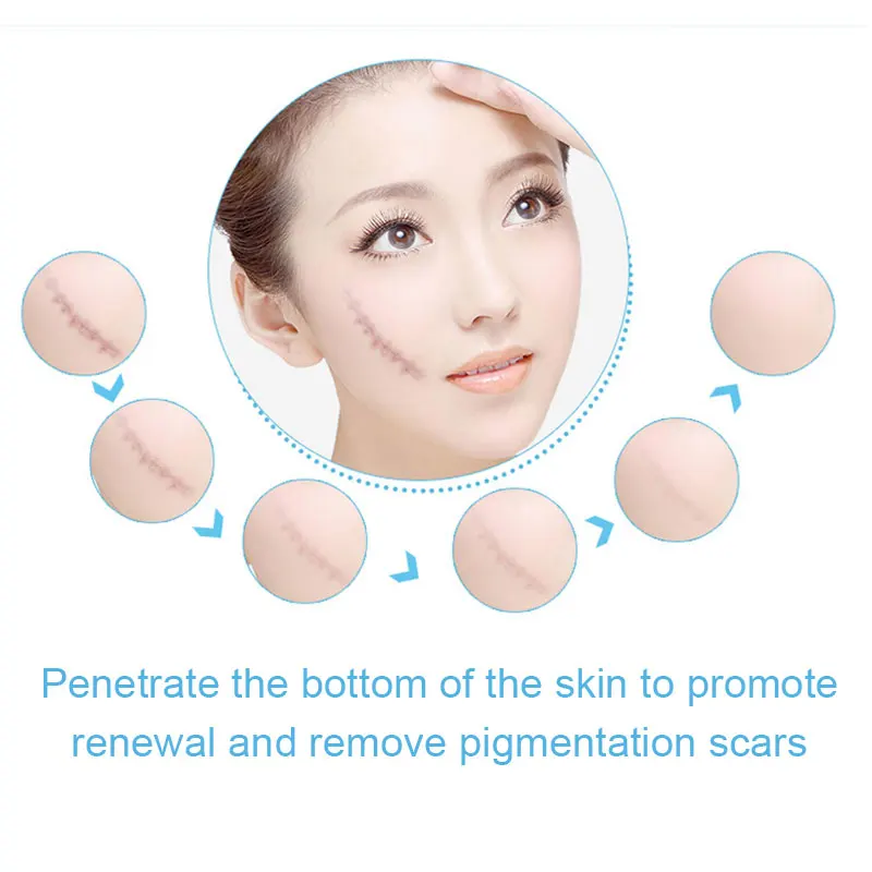 Мазь для лечения рубцов без шрамов уменьшает появление старых и новых