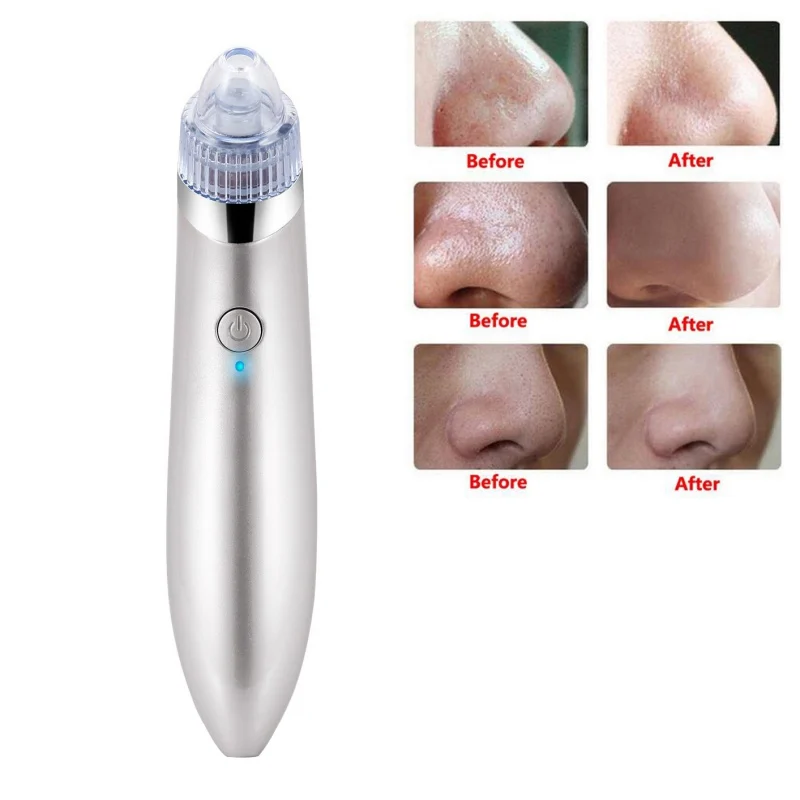 Вакуумный отсос для угрей алмазное удаление втулок акне пилинг пор уход за кожей