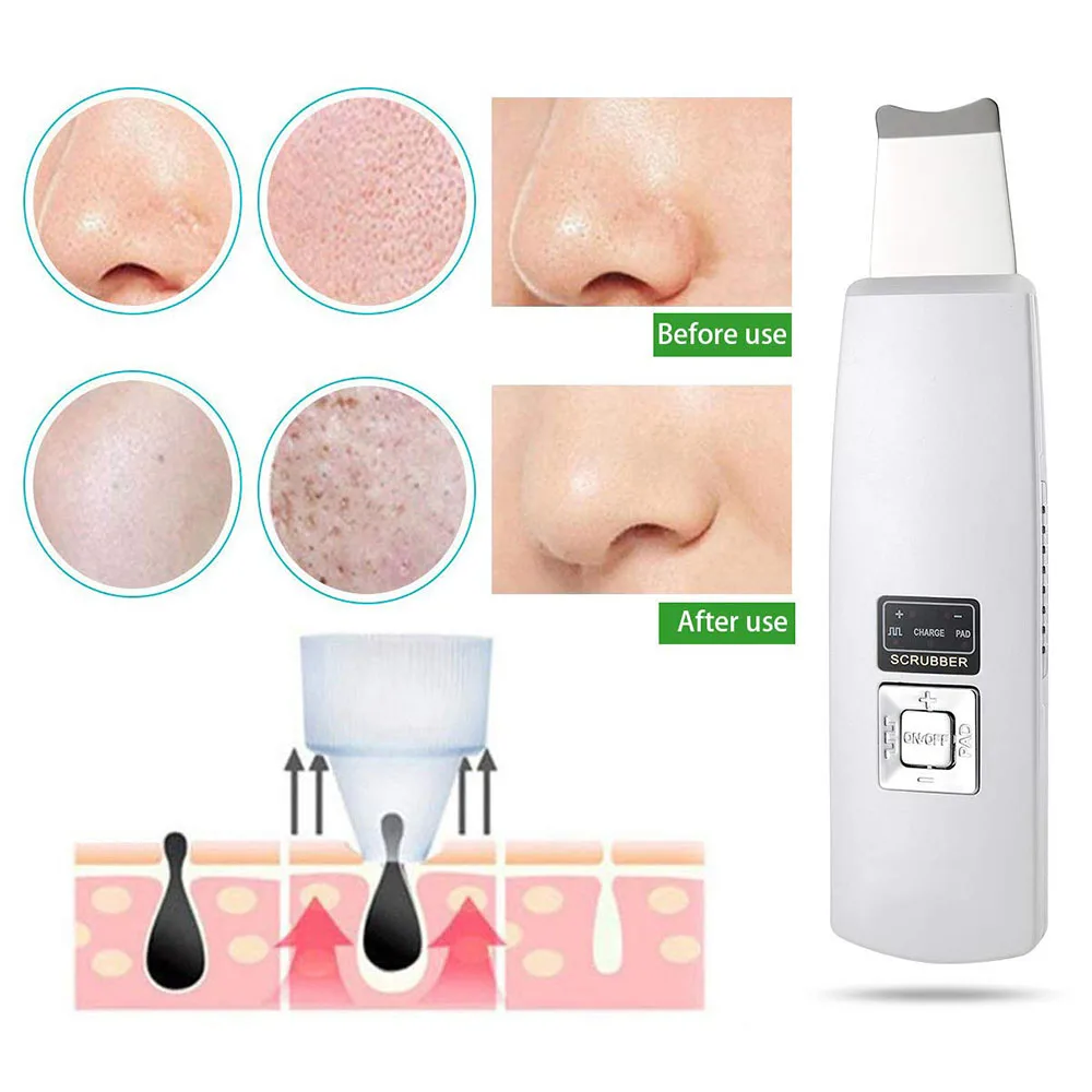 

Портативный ультразвуковой скребок для кожи, очищающее средство для лица, ультразвуковой аппарат для удаления морщин и пор, устройство для ...