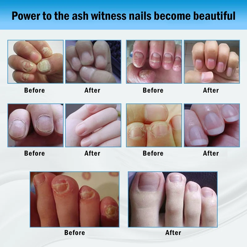 

1pc /4pcs Nail Care Oil Nail Nutrition Oil Softener Natural Cuticle Oil Pen Moisturizing Nutritious Gel Nail Cuticle Care TSLM1