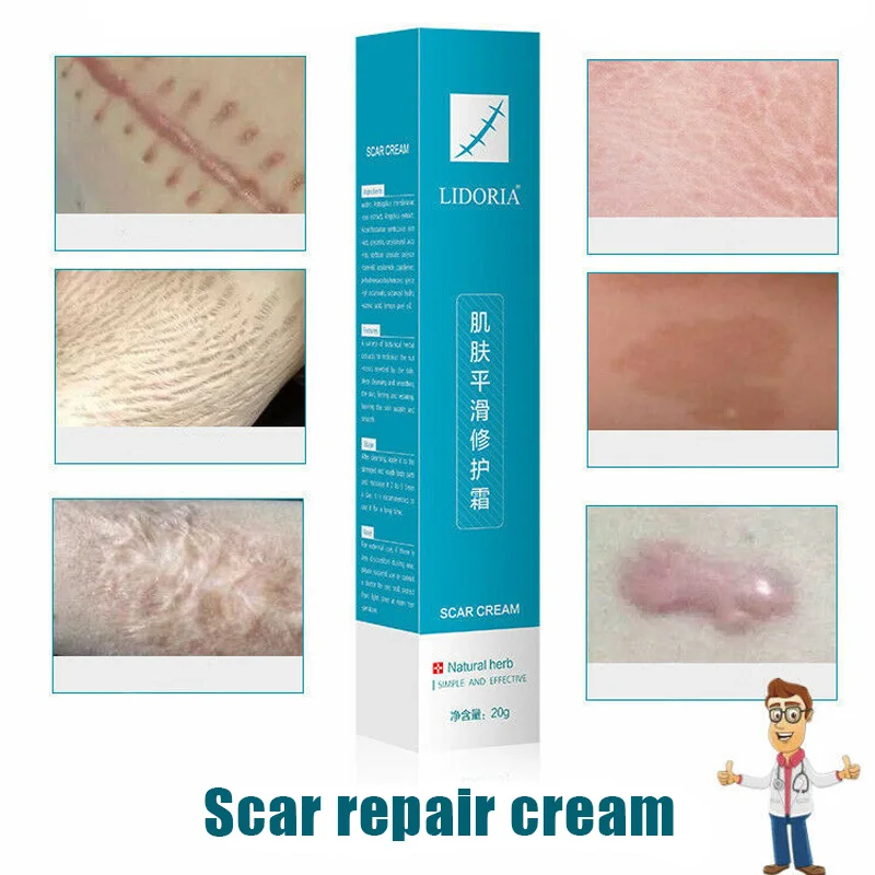 Новейший 20 г Крем для удаления шрамов увлажняющий крем мазь восстановления