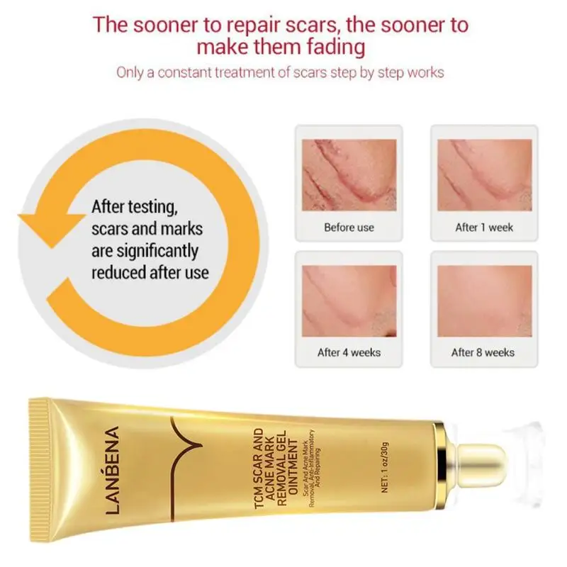 

30g TCM Scar And Acne Mark Removal Gel Ointment Anti Skin Care Acne Treatment Wrinkle O5Y5