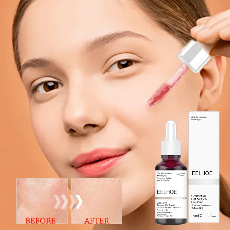 

Face Serum Anti Acne Exfoliating Peeling Solution Pore Shrinking Serum Oil-Control Firming Moisturizing Salicylic Acid Essence