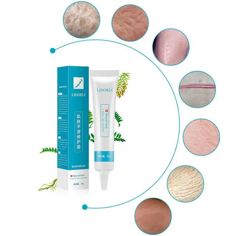 Травяной шрамовый знак удаление кожи тела кремовый дефект уход восстановление