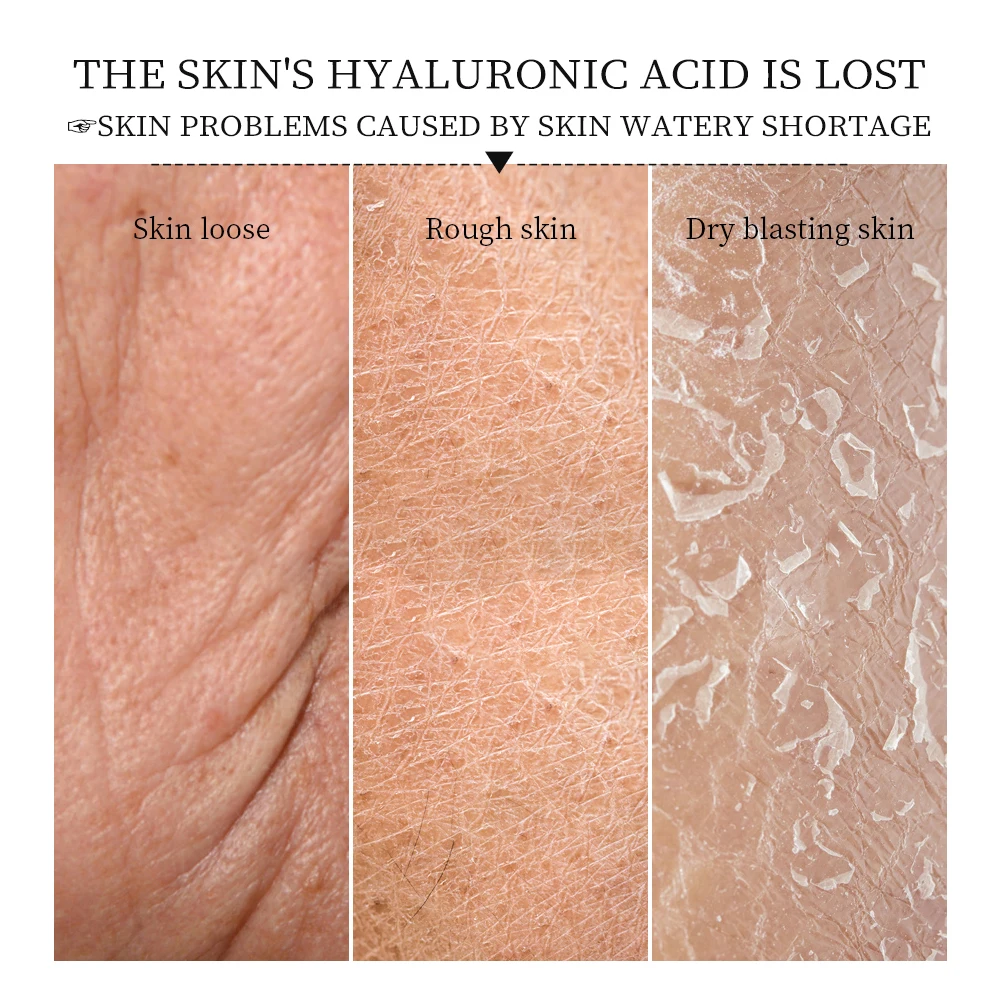 Яркая Гламурная кожа отбеливающая увлажняющая выцветает с мелкими линиями