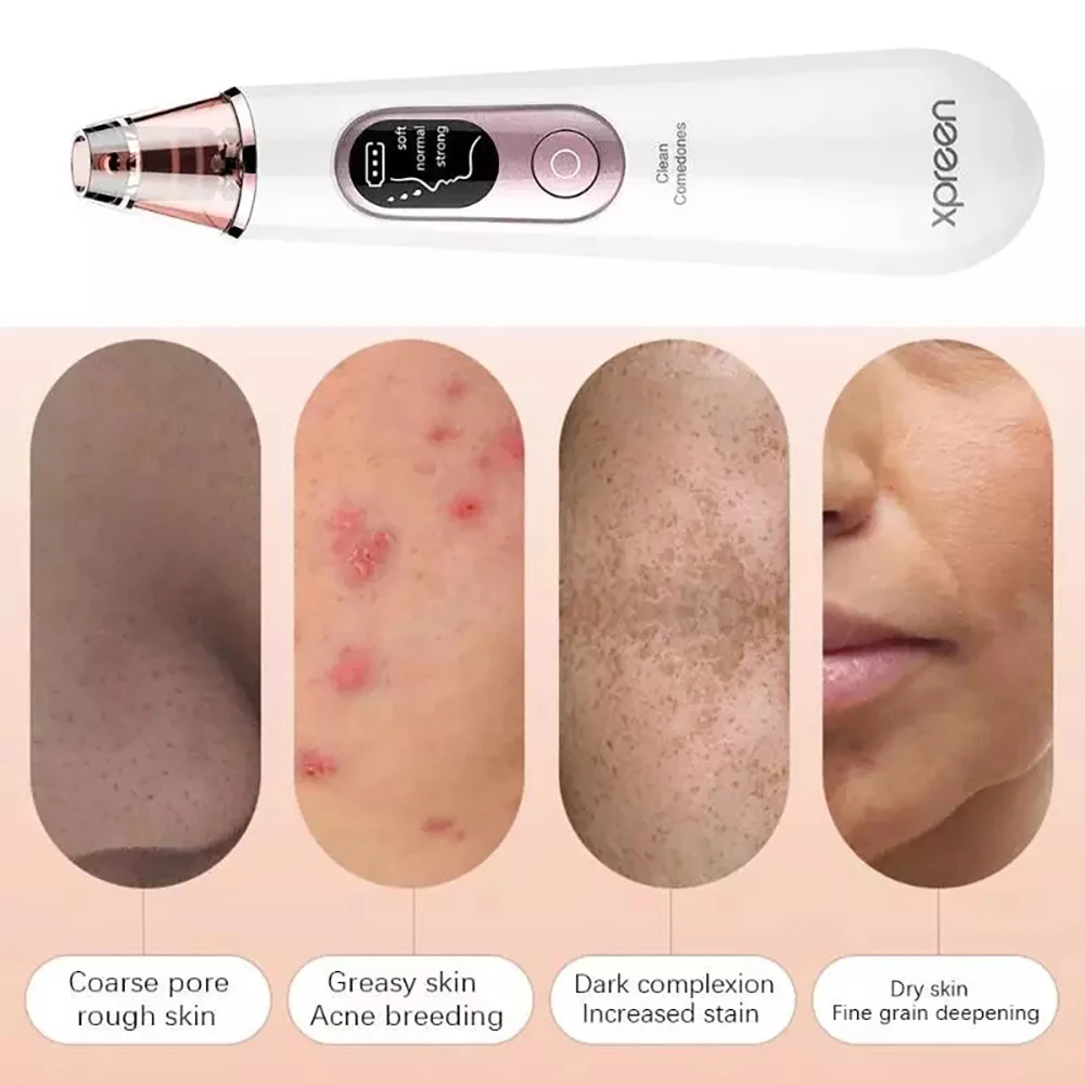 Средство для очищения лица удаление лаковых головок глубокое очищение пылесос