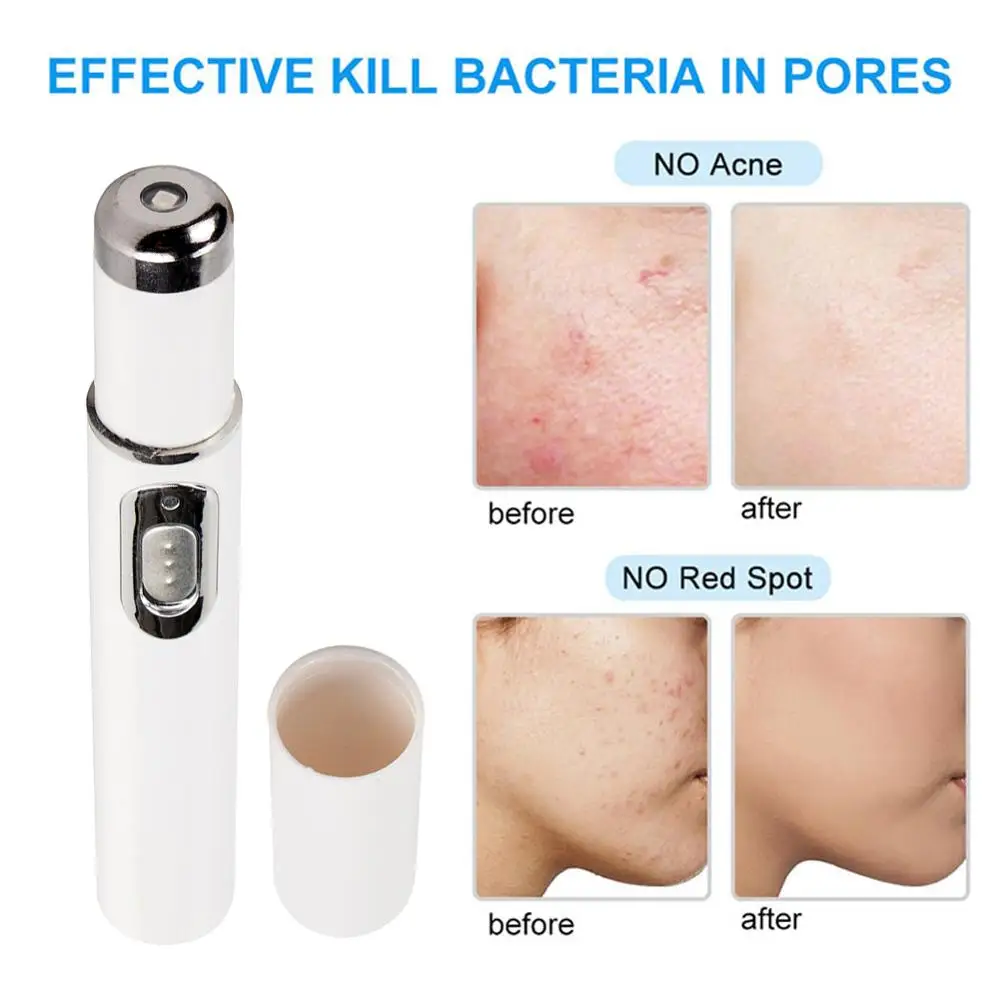Акне лазерная ручка удаление морщин машина Портативный прочный синий светильник