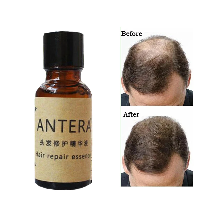 

Hair growth liquid 20ml repair essence nutrition hair growth agent hair growth liquid hair loss products without side effects