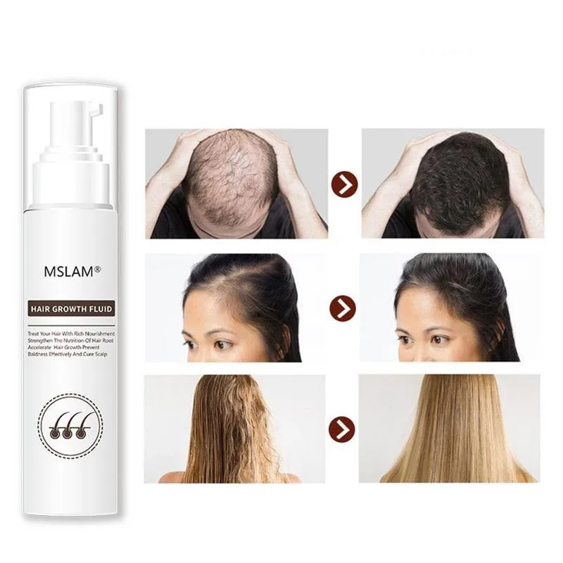 

30ml Hair Regrowth Care Solution Dense Hair Black Growth Hair Soften Solution Growth And Loss Hair Improve Nourish U0J5