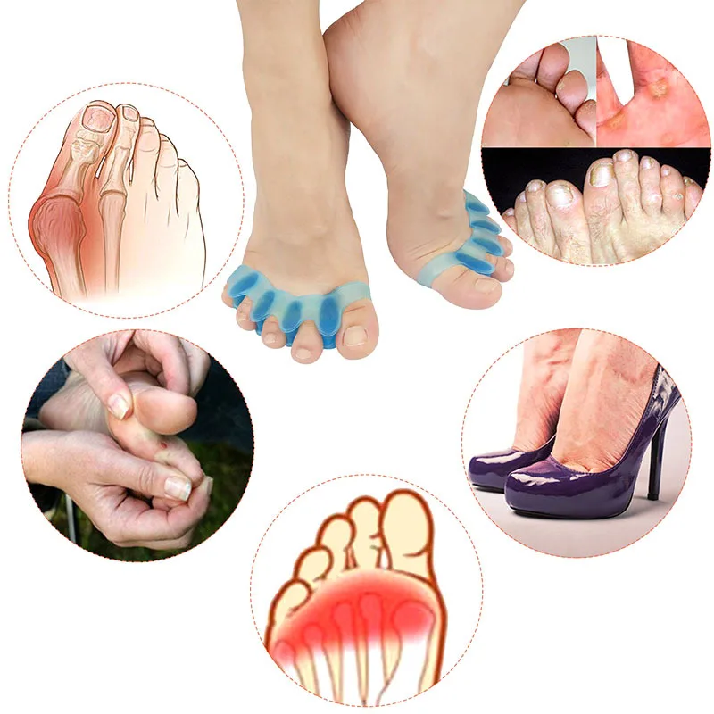 

2pcs=1pair New Protective Toes Separator Suitable Bunion Corrector Material Soft Gel Straightener Spacers Stretchers Care Tool