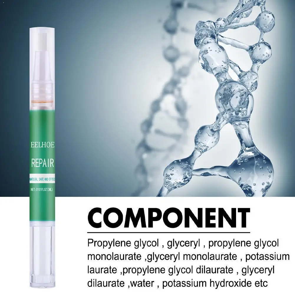 

Nail Anti-fungal Treatment Set Nail Treatment Pen Onychomycosis Kit Fungal Anti Care Serum Fungus Paronychia Repair A3M1