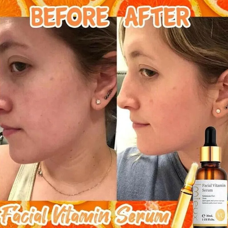 

Organic 30ml Vitamin C Whitening Essence Serum Anti-aging Shrink Pore Hyaluronic Acid Face Serum Moisturizing Skin Care Essence
