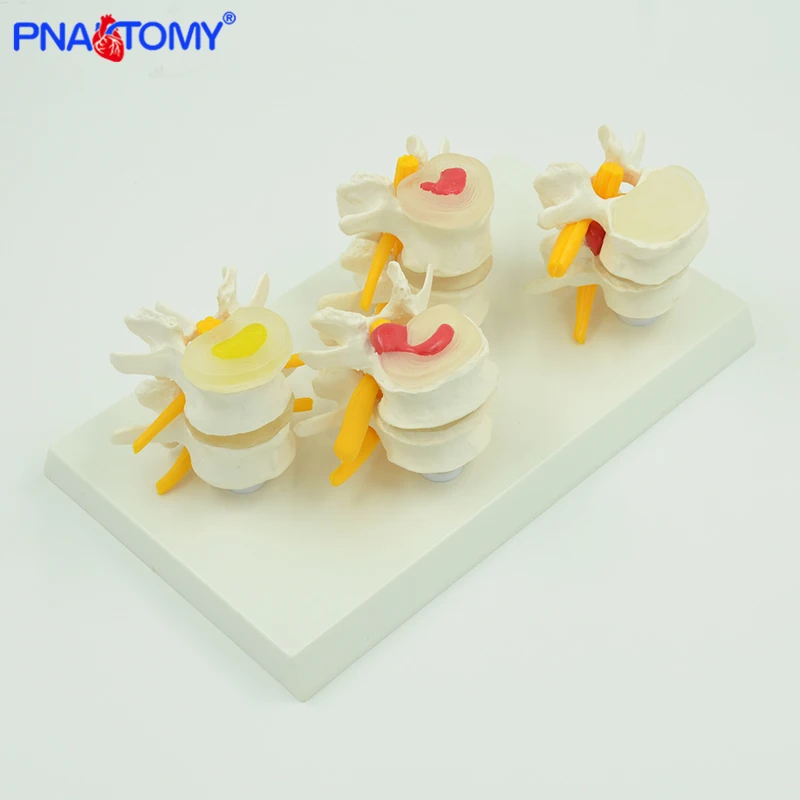 Медицинские реквизиты модель фотоэлемент позвоночника демонстрационная 1