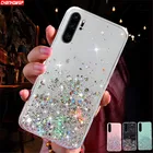 Чехол для Xiaomi Redmi Note 8T, 8, Xiaomi Redmi Note 7, 6, 5 Pro, 8A, 7A, 6A, 5A, 4X, мягкий чехол из ТПУ с блестками