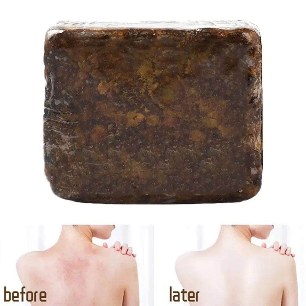 

110g Natural 100% African Black Soap Magic Anti Taches Rebelles Beauty Bath Body Treatment Acne Skin Soap Body Care