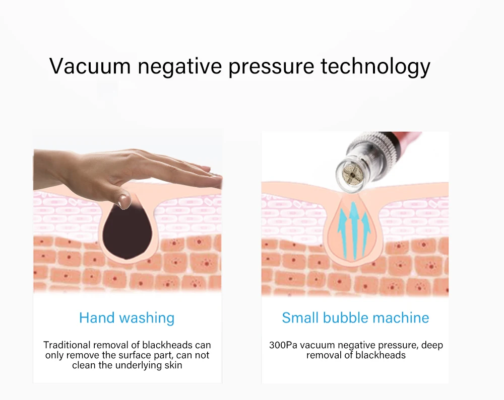 

Small Bubbles Beauty Device Suction Blackhead Removal Vacuum Moisturizing Micro Bubble Oxygen injection Machine for Home Use